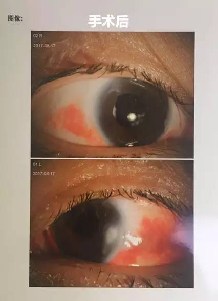 成都6686 - 看球聊球追世界杯就来6686体育有限公司官方网站白内障.jpg