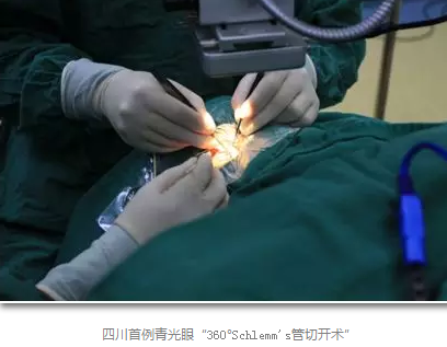 成都6686 - 看球聊球追世界杯就来6686体育有限公司官方网站已经开展的青光眼手术有：引流阀 (钉)植入手术(2015年以来已200多 )，360°Schlemm's管切开术，激光CO2 辅助巩膜深层切除术，小梁切除术青(光眼)白(内障)联合手术。还有虹膜周切术、前房成形术、 虹膜复位术，睫状体冷冻术，小梁切开术和前房穿刺术等6.png
