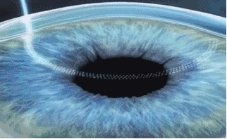 深圳6686 - 看球聊球追世界杯就来6686体育有限公司官方网站近视手术直播预告丨6.24近视手术直播+福利，视界给你！！1.gif