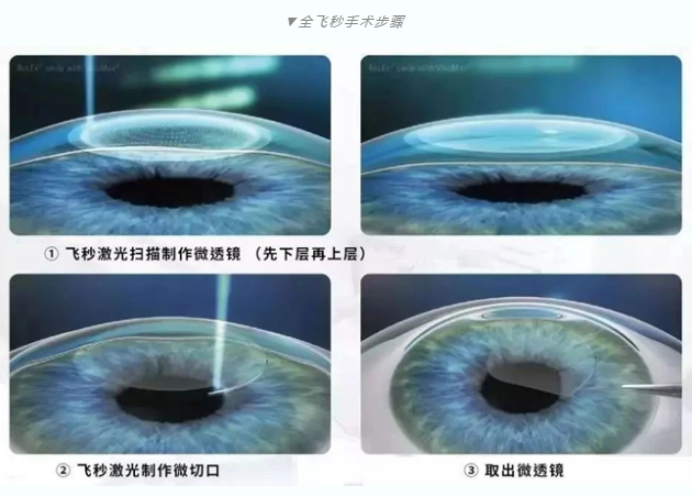7月26日来深圳6686 - 看球聊球追世界杯就来6686体育有限公司官方网站参与暑期摘镜季活动就可以有机会参与抽奖免单手术！2.png