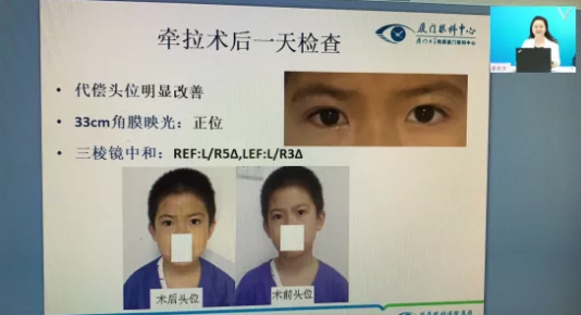 高峰论道·云端荟萃 ▏万人同步在线，30余名大咖云集“第六届6686体育论坛斜视与小儿眼科新技术学习班暨小儿、眼视光分论坛”7.png